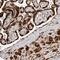 Alpha Kinase 2 antibody, PA5-55763, Invitrogen Antibodies, Immunohistochemistry frozen image 