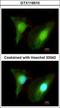 Histone methyltransferase SMYD2 antibody, GTX116510, GeneTex, Immunocytochemistry image 