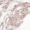 Collagen Type VI Alpha 1 Chain antibody, A02226-2, Boster Biological Technology, Immunohistochemistry frozen image 