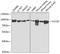 Chloride Voltage-Gated Channel 5 antibody, A5707, ABclonal Technology, Western Blot image 