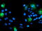 Serine Peptidase Inhibitor, Kunitz Type 1 antibody, LS-C797570, Lifespan Biosciences, Immunofluorescence image 