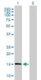 Zinc Finger HIT-Type Containing 1 antibody, H00010467-B01P, Novus Biologicals, Western Blot image 