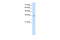 Transient receptor potential cation channel subfamily M member 5 antibody, 28-257, ProSci, Enzyme Linked Immunosorbent Assay image 