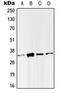 Single-Strand-Selective Monofunctional Uracil-DNA Glycosylase 1 antibody, orb215092, Biorbyt, Western Blot image 