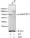 Arachidonate 5-Lipoxygenase antibody, A00847S271, Boster Biological Technology, Western Blot image 