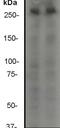 Mechanistic Target Of Rapamycin Kinase antibody, ab32028, Abcam, Western Blot image 