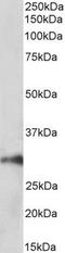 Homeobox A5 antibody, TA348958, Origene, Western Blot image 