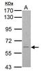 Calcium Voltage-Gated Channel Auxiliary Subunit Beta 4 antibody, GTX113638, GeneTex, Western Blot image 