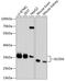 Glyoxalase Domain Containing 4 antibody, A13315, Boster Biological Technology, Western Blot image 