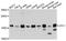 Cofilin 1 antibody, STJ23107, St John