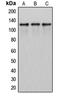 Inositol-Trisphosphate 3-Kinase B antibody, LS-C352393, Lifespan Biosciences, Western Blot image 