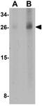 Empty Spiracles Homeobox 2 antibody, GTX17164, GeneTex, Western Blot image 