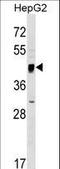 Serine Incorporator 2 antibody, LS-C158944, Lifespan Biosciences, Western Blot image 