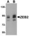 Zinc Finger E-Box Binding Homeobox 2 antibody, LS-B5294, Lifespan Biosciences, Western Blot image 