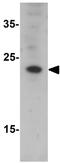 Coiled-Coil-Helix-Coiled-Coil-Helix Domain Containing 6 antibody, GTX32100, GeneTex, Western Blot image 