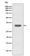 Caspase 6 antibody, M02631-2, Boster Biological Technology, Western Blot image 