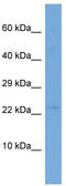 Odorant Binding Protein 2A antibody, TA334553, Origene, Western Blot image 