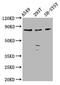 Zinc Finger CCCH-Type Containing 14 antibody, CSB-PA740793LA01HU, Cusabio, Western Blot image 