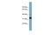 Methionyl Aminopeptidase 1 antibody, GTX45324, GeneTex, Western Blot image 