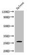 Zinc Finger C4H2-Type Containing antibody, orb46563, Biorbyt, Western Blot image 