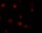 Zinc Finger MIZ-Type Containing 1 antibody, A04537, Boster Biological Technology, Immunofluorescence image 