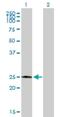 Carbonyl Reductase 4 antibody, H00084869-B01P, Novus Biologicals, Western Blot image 