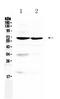 Aryl Hydrocarbon Receptor Nuclear Translocator Like antibody, A00260-1, Boster Biological Technology, Western Blot image 