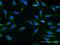 ATP Binding Cassette Subfamily G Member 1 antibody, H00009619-M03, Novus Biologicals, Immunocytochemistry image 