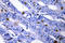 Protein Kinase CAMP-Dependent Type II Regulatory Subunit Beta antibody, LS-C177434, Lifespan Biosciences, Immunohistochemistry paraffin image 
