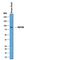Fibroblast Growth Factor Receptor 4 antibody, PA5-47282, Invitrogen Antibodies, Western Blot image 