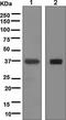 Arginase 1 antibody, ab133543, Abcam, Western Blot image 