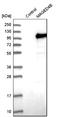 MAGE Family Member D4B antibody, NBP1-89594, Novus Biologicals, Western Blot image 