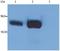 Lymphocyte Cytosolic Protein 2 antibody, M04880, Boster Biological Technology, Western Blot image 