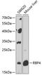 Retinol Binding Protein 4 antibody, 14-460, ProSci, Western Blot image 