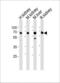 Acyl-CoA Synthetase Medium Chain Family Member 5 antibody, PA5-49396, Invitrogen Antibodies, Western Blot image 