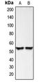 Bone Morphogenetic Protein 3 antibody, LS-C351869, Lifespan Biosciences, Western Blot image 