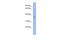 Vesicle Trafficking 1 antibody, A06279, Boster Biological Technology, Western Blot image 