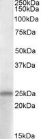 Adenylate Cyclase Activating Polypeptide 1 antibody, PA5-19147, Invitrogen Antibodies, Western Blot image 