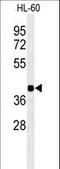 Retinal G Protein Coupled Receptor antibody, LS-C162569, Lifespan Biosciences, Western Blot image 