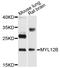 Myosin Light Chain 12B antibody, STJ24665, St John