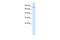 Zinc Finger Protein 341 antibody, PA5-40309, Invitrogen Antibodies, Western Blot image 