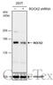 Rho Associated Coiled-Coil Containing Protein Kinase 2 antibody, GTX633389, GeneTex, Western Blot image 