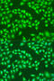 Radical S-adenosyl methionine domain-containing protein 2 antibody, 23-486, ProSci, Immunofluorescence image 