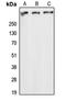 ATM Serine/Threonine Kinase antibody, LS-C353719, Lifespan Biosciences, Western Blot image 