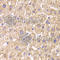 ST3 Beta-Galactoside Alpha-2,3-Sialyltransferase 3 antibody, A6753, ABclonal Technology, Immunohistochemistry paraffin image 