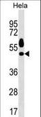 Serum/Glucocorticoid Regulated Kinase 1 antibody, LS-C158256, Lifespan Biosciences, Western Blot image 