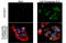 Sequestosome 1 antibody, GTX128171, GeneTex, Immunocytochemistry image 