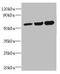 Oxysterol Binding Protein Like 2 antibody, CSB-PA884442LA01HU, Cusabio, Western Blot image 