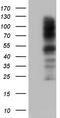 Carcinoembryonic Antigen Related Cell Adhesion Molecule 5 antibody, CF803415, Origene, Western Blot image 