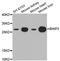 BCL2 Interacting Protein 3 antibody, OAAN03512, Aviva Systems Biology, Western Blot image 